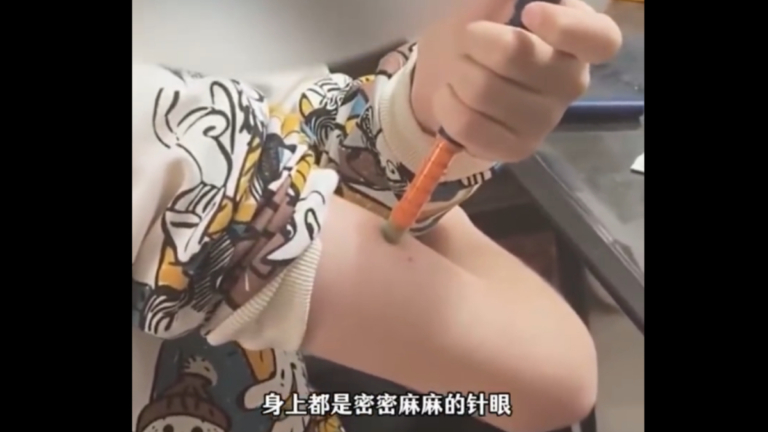 打2940針！中國14歲男孩被誤診 注激素後患糖尿病