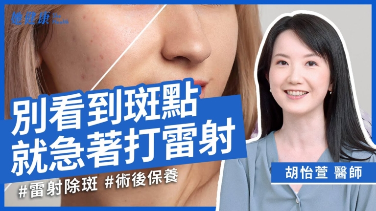【她健康】別看到斑點就急著打鐳射