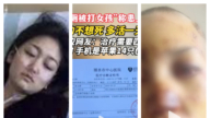 “浙江公厕打人案”受害女孩确诊白血病 上网求助