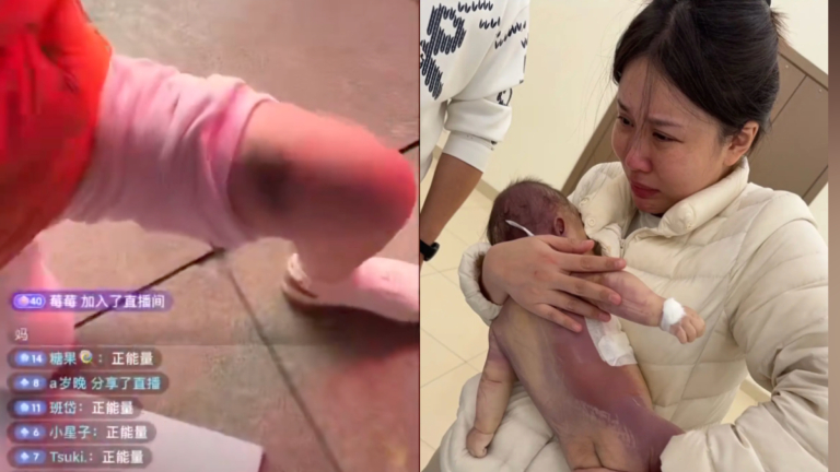 寧波五個月的嬰兒手術身亡 媽媽維權遭毆打封殺（視頻）