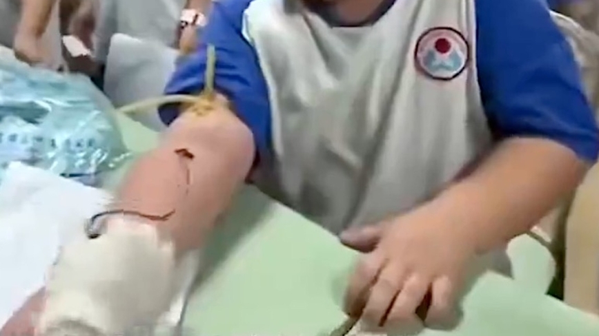 再爆醜聞 山西幼兒園未通知家長私自抽血體檢