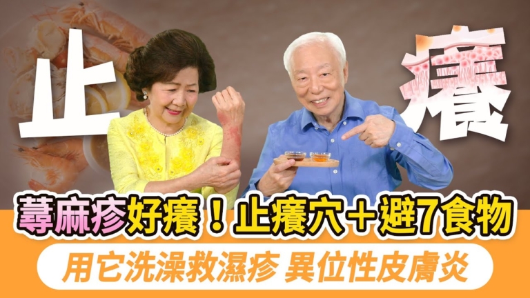 【胡乃文】蕁麻疹好癢 止癢穴+避7食物