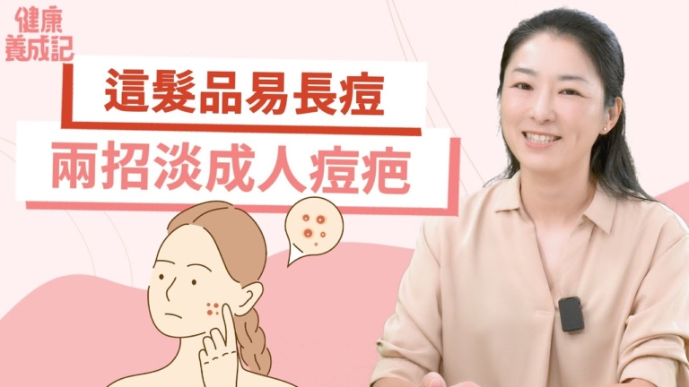 【健康養成記】成人長痘最重要的是儘快消炎