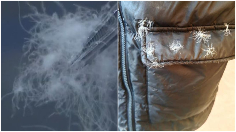 破舊羽絨服惹禍！福建男患「羽絨肺」緊急送醫