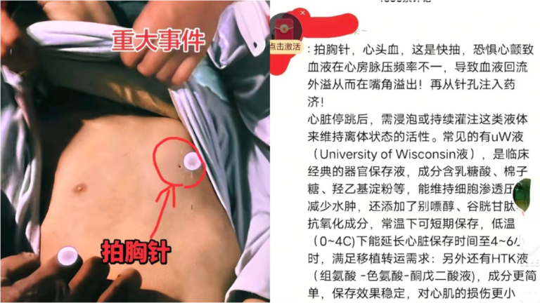 河南中學生死亡涉盜取器官？官方通報惹廣泛質疑