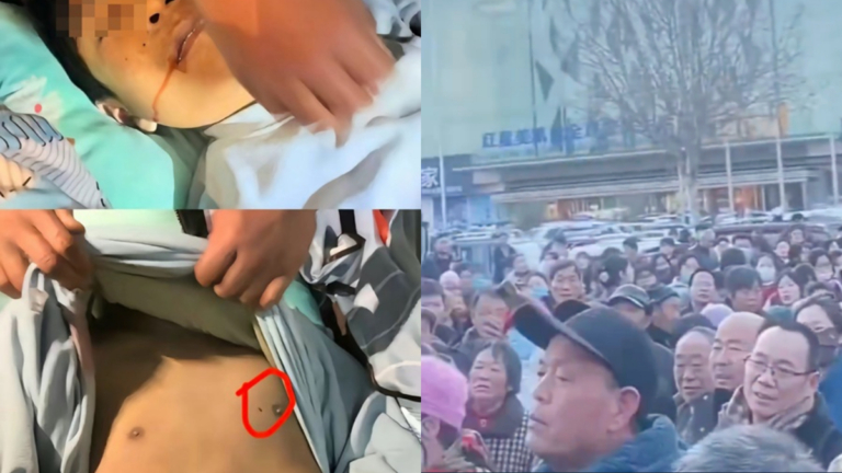 新蔡男孩胸洞疑團 醫生普及心臟停跳液影片被關注（視頻）
