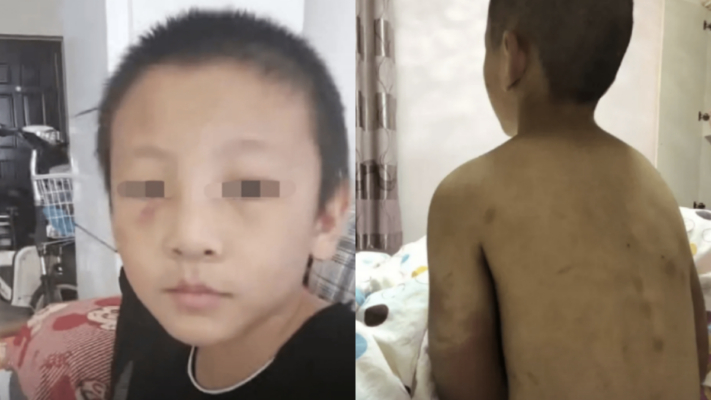 河南14歲男孩遭生父繼母虐死 最後哀求：給我水喝