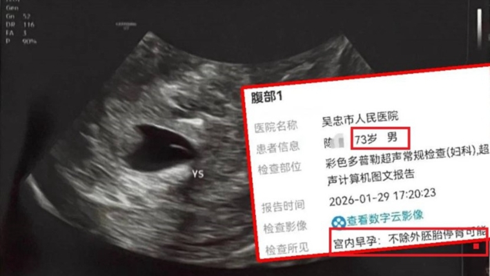 中國73歲爺爺求醫 醫院離譜診斷：宮內早孕