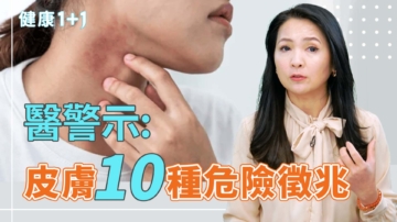 【健康1+1】醫警示：皮膚10種危險徵兆