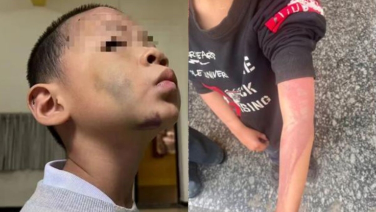 暴打燙下體逼吃大便 中國再爆繼母虐待幼兒慘案