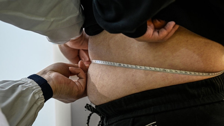 減重勿只減熱量 醫師：避免肌肉流失成「泡芙人」