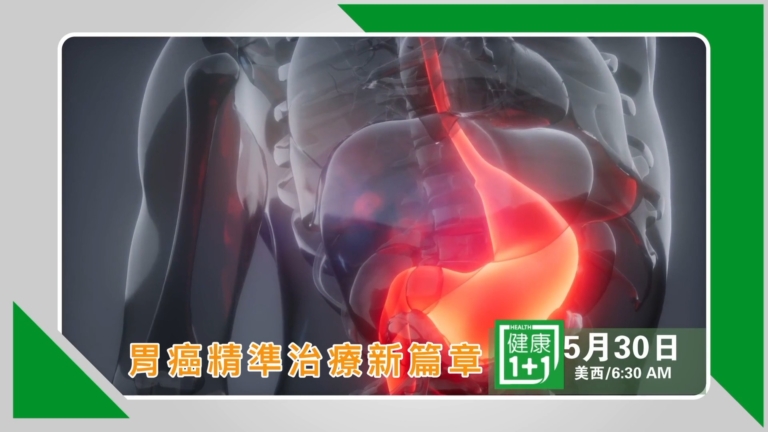 【節目預告】健康1+1：胃癌精準治療新篇章