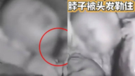 母亲长发险夺命!2岁童被缠住脖子 母惊醒撕发救命