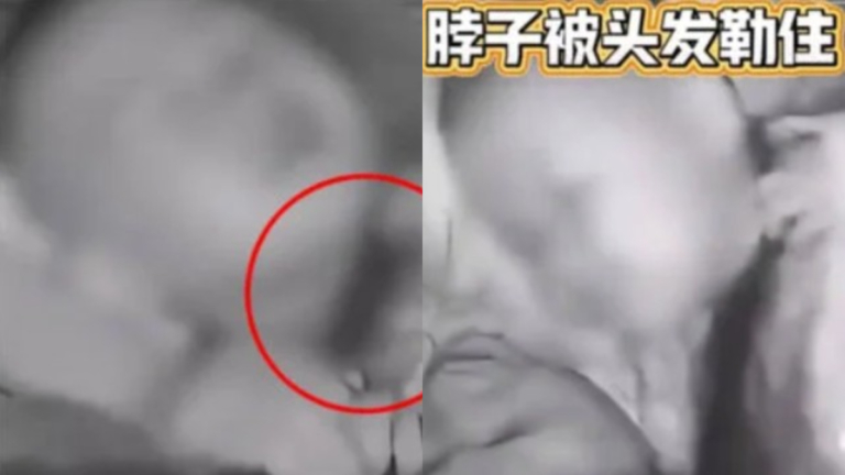 母親長髮險奪命！2歲童被纏住脖子 母驚醒撕髮救命