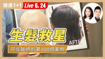 【健康1+1】生发救星 阿信医师的第100个案例