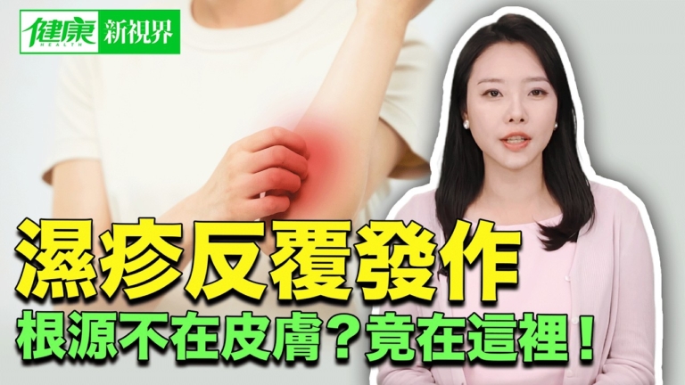 【健康新視界】濕疹反覆發作 根源不在皮膚?