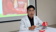 喝牛奶助眠 上班族竟罹「猛爆性齲齒」