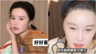 趙本山女兒球球自曝患三種精神疾病 引發熱議