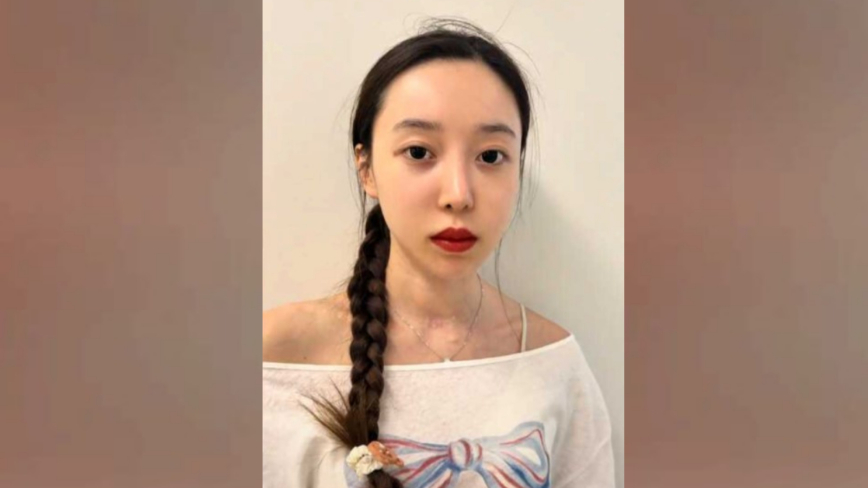 中国女星心脏骤停成植物人 昏迷3月苏醒留后遗症