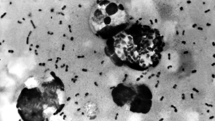 俄国实验室人员疑感染死亡 肺鼠疫症状疗法一次看