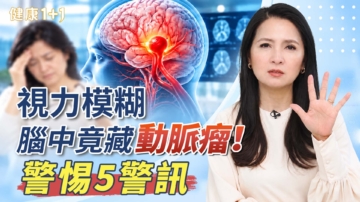 【健康1+1】視力模糊 腦中竟藏動脈瘤！警惕5警訊