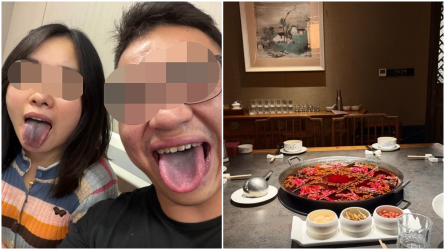 重庆4人聚餐后舌头发黑 原因不明